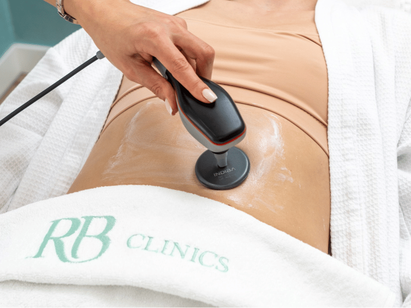 Close-up van de Indiba applicator op de buik met een RB Clinics handdoek